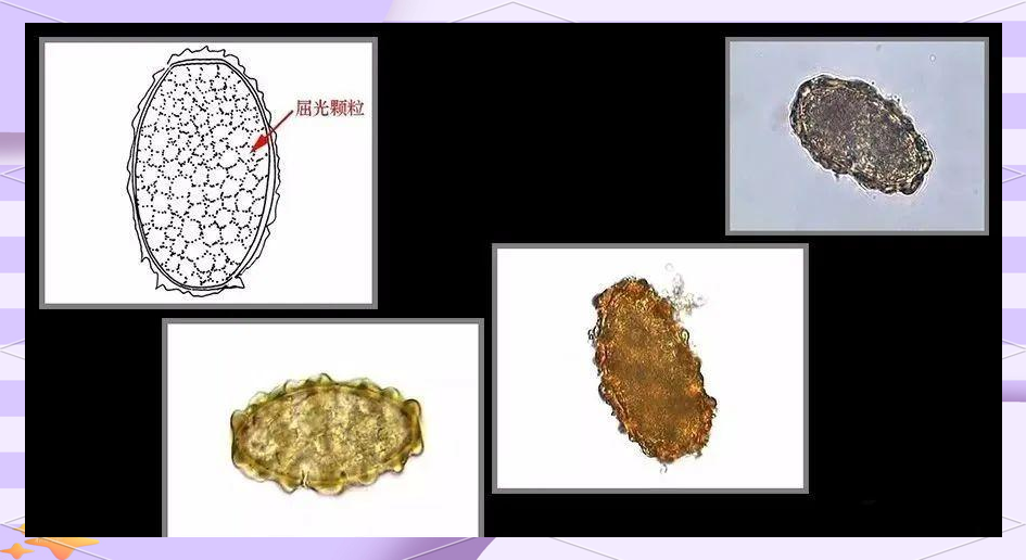 火影花火 身份:雏田的火影花火妹妹