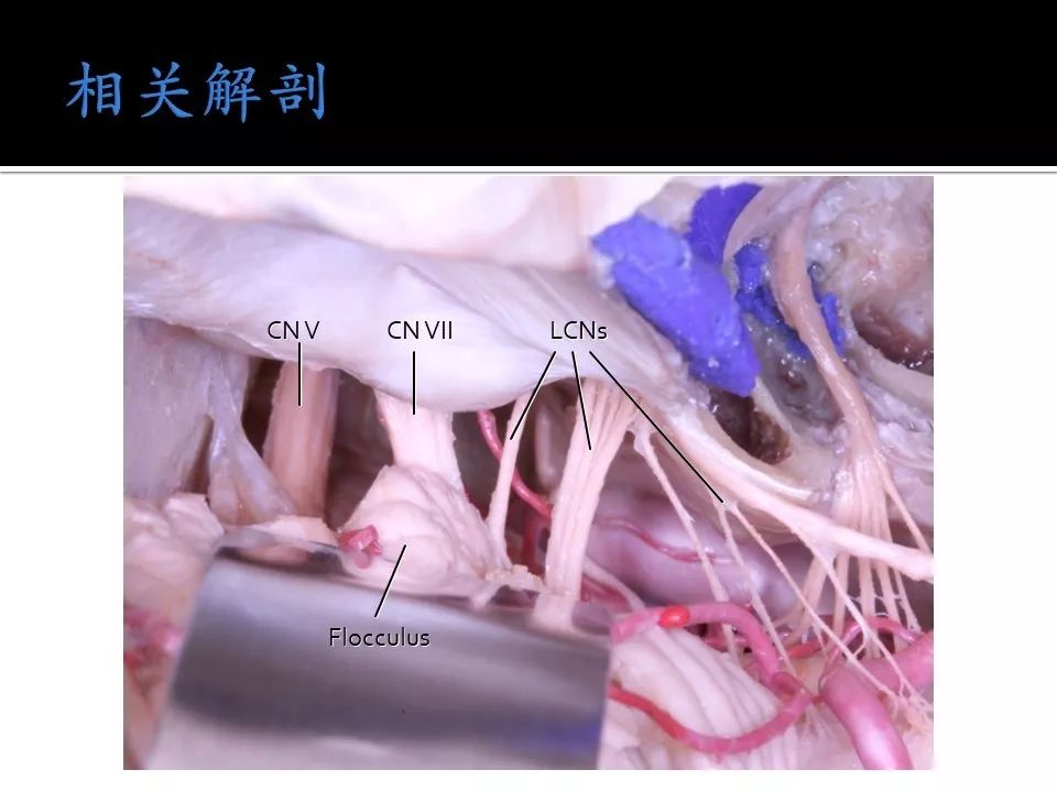 新优 咨询、新优使用场景等）