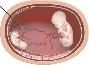 手冲大赛 学习与社区无缝连接