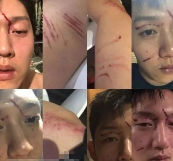 美国ZOOM人与ZOOM视频