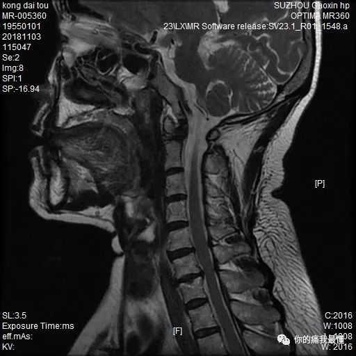 17c一起草免费观看完整版 主打“零门槛观看”概念